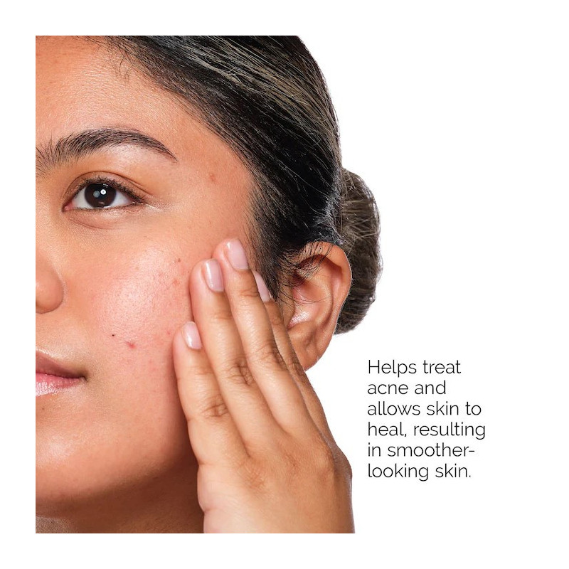 The Ordinary Acne Set The Ordinary Acne Set