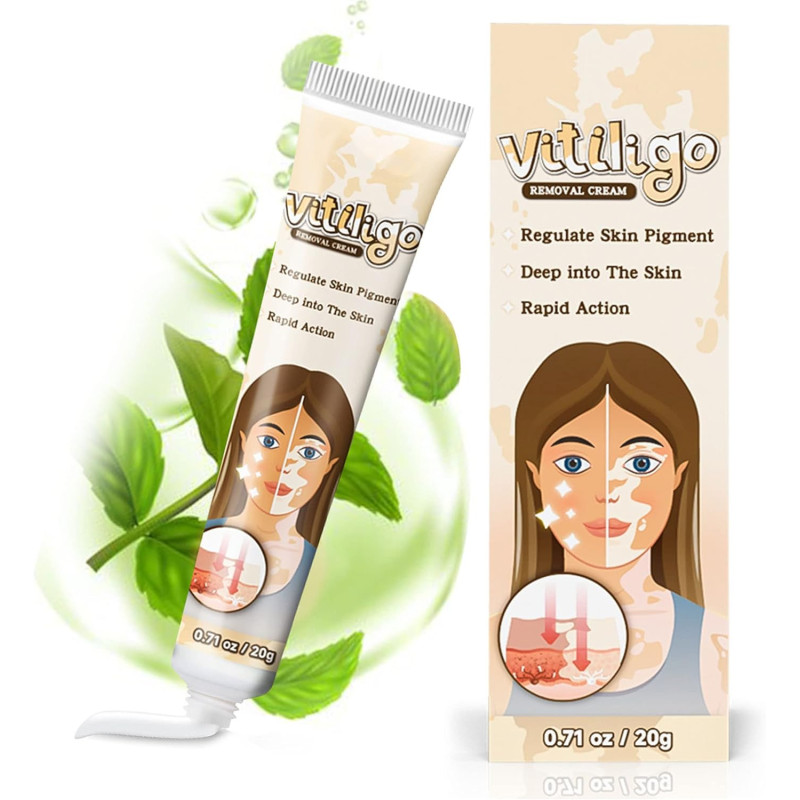 Crema Tratamiento del Vitiligo Feugole Crema Tratamiento del Vitiligo Feugole
