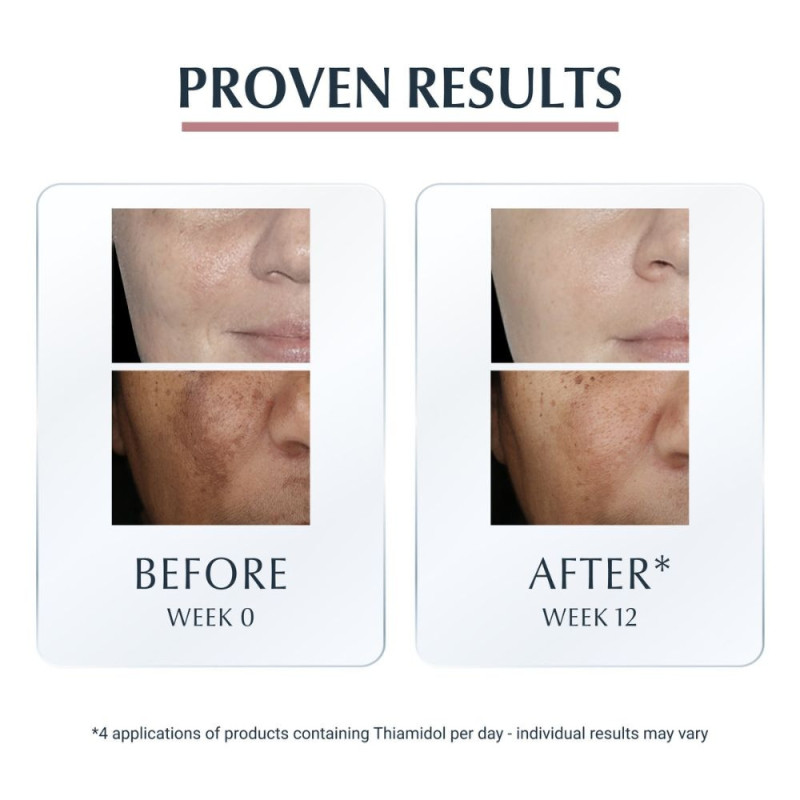 Eucerin Anti Pigmento Radiant Tone Eucerin Anti Pigmento Radiant Tone